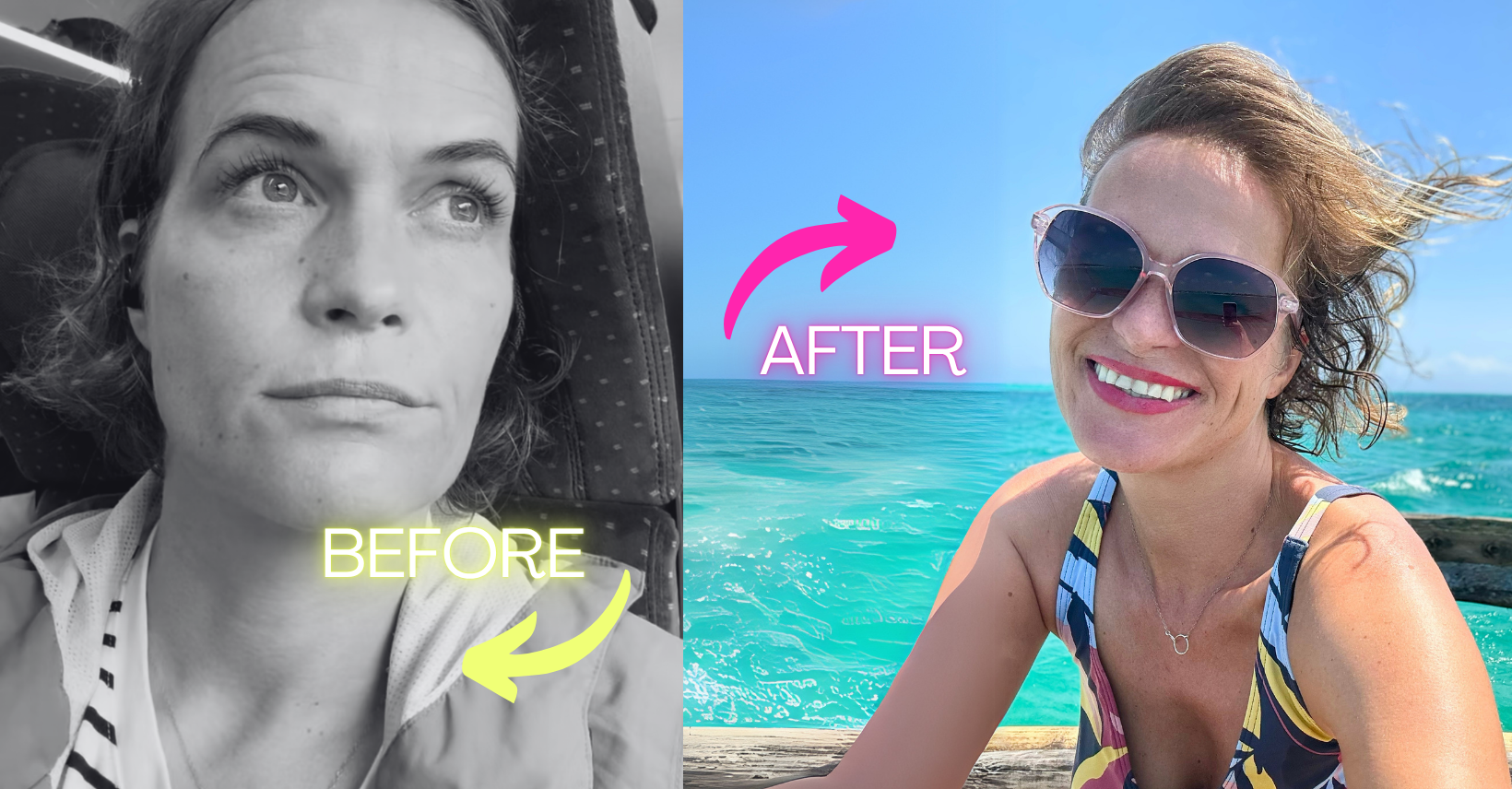 Linda vorher nachher